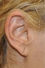 TLC for Tired Earlobes!